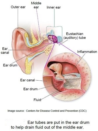 Emergency eye and ear infections in babies chart.
