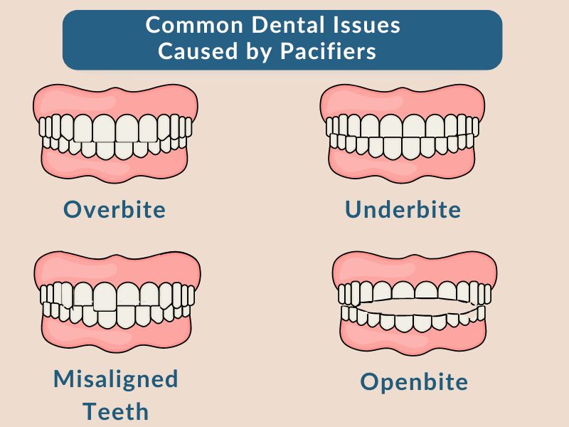 Pediatrician explaining dental issues from prolonged pacifier use. This is a pacifier dental problems. Can pacifiers cause speech delay, baby with pacifier