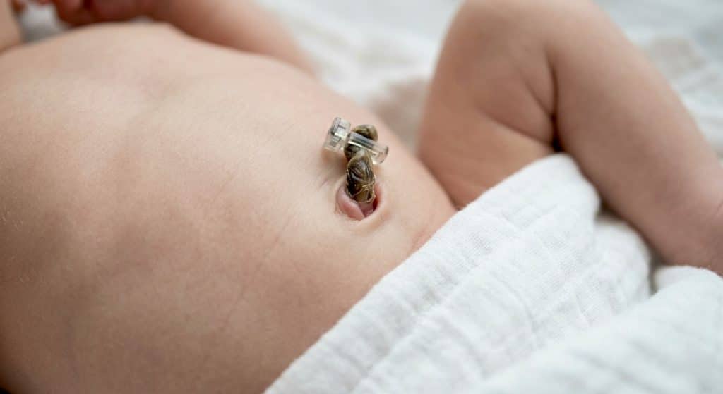 Normal newborn umbilical cord stump healing process compared to newborn illness warning signs of infection